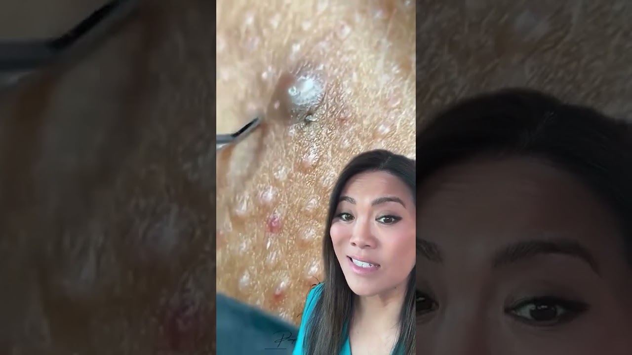 Download the When Does Dr Pimple Popper Come On series from Mediafire