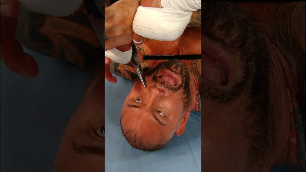 Download the How To Watch Aew Wrestling series from Mediafire Download the How To Watch Aew Wrestling series from Mediafire